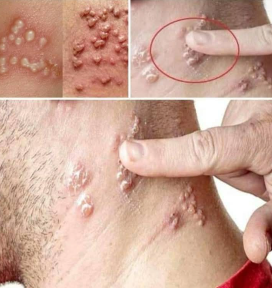 ⚠️ BE CAREFUL, If You Spot These Dots On Your Skin, It Means You Have Ca…See More